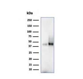 Western blot testing of human 1) spleen and 2) Raji cell lysate using CD38 antibody (clone CD384328)