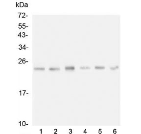 Western blot testing of 1) rat liver, 2) rat testis, 3) rat NRK cell, 4) mouse liver, 5) mouse testi
