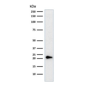 p21 Antibody Cocktail / CDKN1A