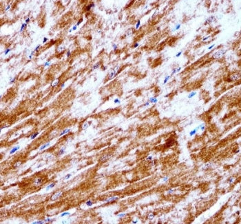 IHC testing of FFPE mouse heart tissue with Pyruvate dehydrogenase kinase 2 antibody. HIER: steam se