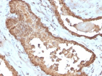 IHC staining of FFPE human prostate tissue with MIF antibody (clone MIF/6279). HIER: boil tissue sec