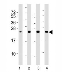 Western blot testing of SOD2 antibody at 1:2000 dilution and human samples. Lane 1: HeLa lysate; 2: 