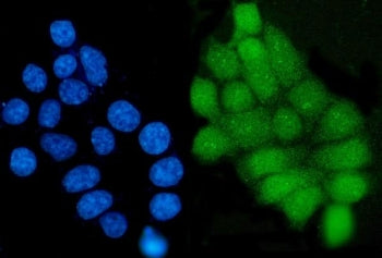 Immunofluorescent staining of FFPE human MCF7 cells with GRHL1 antibody (green) and DAPI nuclear sta