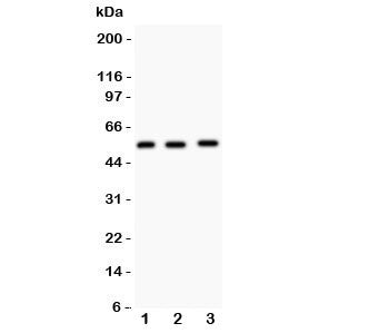 Western blot testing of MMP14 antibody and Lane 1: human placenta; 2: HeLa; 3: U87 lysate. Predicted