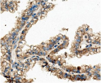 Ch-TOG Antibody / CKAP5