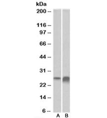 Western blot testing of human kidney [A] and liver [B] lysate with APOD antibody at 0.3ug/ml. Predic