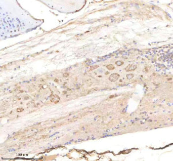 IHC staining of FFPE zebrafish spinal cord tissue with Pik3cb antibody, HRP-labeled secondary and DA