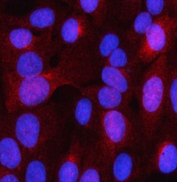 Immunofluorescent staining of FFPE human U-2 OS cells with LHPP antibody (red) and DAPI nuclear stai