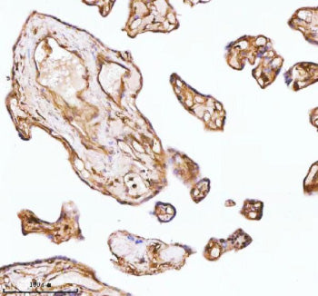 Immunohistochemical staining of GNAI2 using anti-GNAI2 antibody. GNAI2 was detected in a paraffin-em
