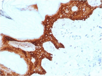 IHC staining of FFPE human skin with 14-3-3 Sigma antibody (clone CPTC-SFN-2). HIER: boil tissue sec