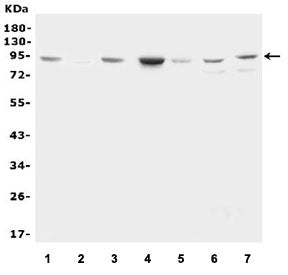 Western blot testing of 1) rat kidney, 2) rat lung, 3) rat heart, 4) mouse kidney, 5) mouse lung, 6)