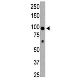 HDAC4 antibody used in western blot to detect HDAC4 in mouse brain tissue lysate. Expected molecular