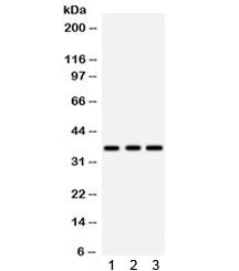 IGFBP2 Antibody