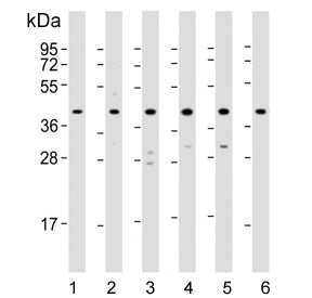 Western blot testing of 1) human HepG2, 2) human HeLa, 3) rat PC-12, 4) human Jurkat, 5) human MCF7 