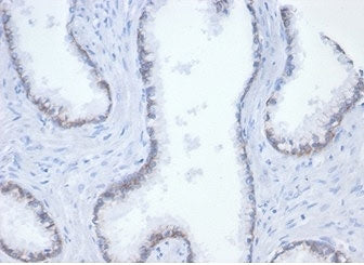 Beta Catenin Antibody