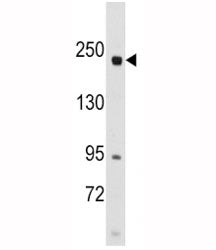 RICTOR Antibody