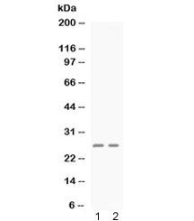 PF4 Antibody / Platelet factor 4