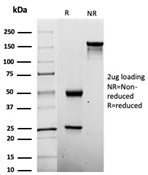 Penicillin Antibody