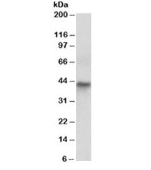 Western blot testing of human colon cancer lysate with Cytokeratin 19 antibody at 0.03ug/ml. Predict