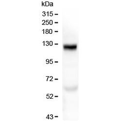 Western blot testing of human placenta with COL17A1 antibody at 0.5ug/ml. Expected molecular weight ~120 kDa and ~180 kDa.