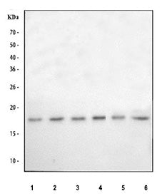 Immunofluorescent staining of FFPE human U-2 OS cells with POLR2D antibody (red) and Beta Tubulin mA
