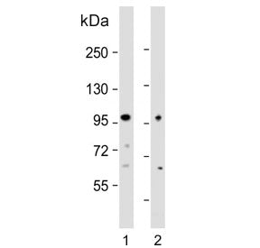 Western blot testing of human 1) A549 and 2) LOVO cell lysate with EPS8 antibody. Expected molecular