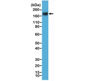 Western blot testing of human MCF7 cell lysate with recombinant CEA antibody at 1:000. Expected mole