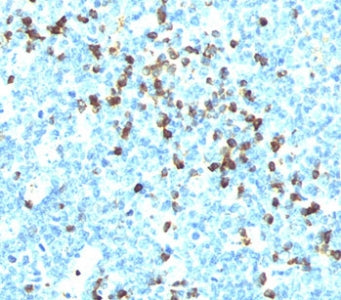 Lambda Light Chain Antibody / Lambda Antibody