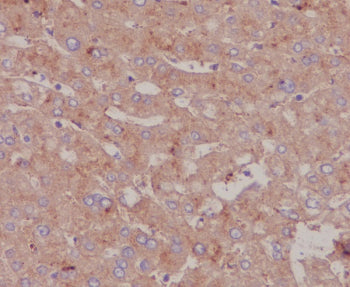 IHC staining of FFPE human liver tissue with Serum Albumin antibody. HIER: boil tissue sections in p