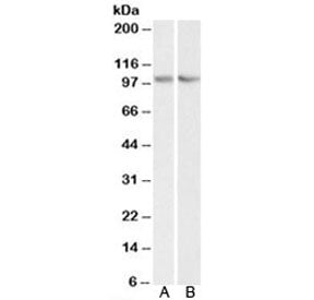 Western blot testing of human HEK293 [A] and mouse NIH3T3 [B] lysate with TRIM71 antibody at 0.3ug/m