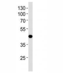 AIM2 Antibody
