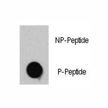 Phospho-TSC2 Antibody (pT1462)
