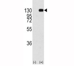 Western blot analysis of FGFR antibody and 293 cell lysate (2 ug/lane) either nontransfected (Lane 1
