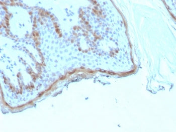 Filaggrin Antibody