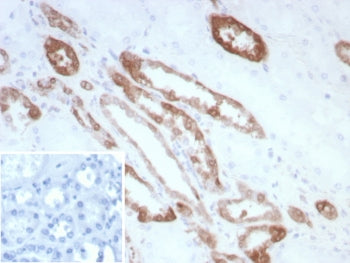 CKB Antibody / Creatine kinase B