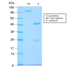 GnRH Receptor Antibody / LHCG Receptor