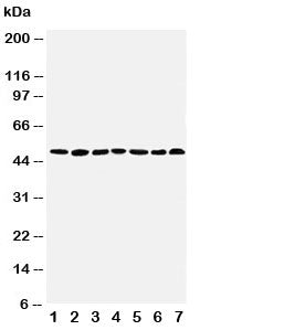 Western blot testing of CTBP1 antibody and Lane 1: rat brain; 2: rat testis; 3: rat ovary; 4: U87; 5