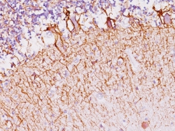 IHC: Formalin-fixed, paraffin-embedded human cerebellum stained with Neurofilament antibody (SPM145)