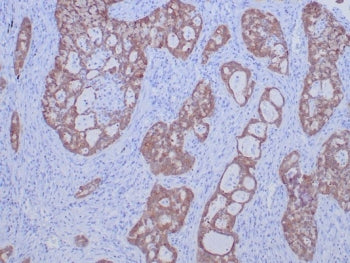ROS1 Antibody