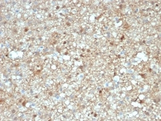 IHC staining of FFPE human brain tissue with S100B antibody (clone S100B/4143) at 2ug/ml. HIER: boil