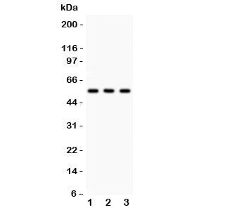 Western blot testing of PLTP antibody and 1. MCF7, 2. Raji and 3. HeLa lysate. Expected/observed siz