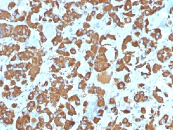 Growth Hormone Antibody / GH1