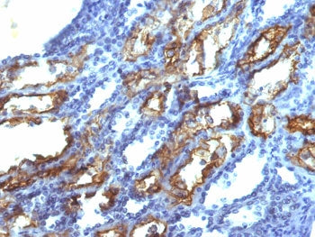 Interferon gamma Antibody / IFNG