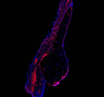 Immunofluorescent staining of FFPE zebrafish embryo tissue with Zebrafish Atp6v1a antibody (red) and