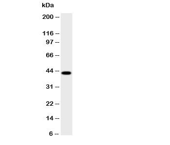 Western blot testing of HSD17B2 antibody and human placenta lysate; Predicted size: 43KD; Observed s