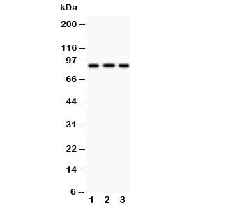 Western blot testing of CUL1 antibody and Lane 1: MM453; 2: HT1080; 3: SMMC-7721; Predicted/observed
