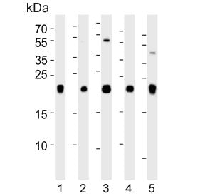 Western blot testing of human 1) A375, 2) HeLa, 3) HepG2, 4) mouse brain and 5) rat liver lysate wit