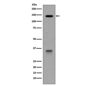 Western blot testing of human HepG2 cell lysate with LDLR antibody. Expected molecular weight: 95-16