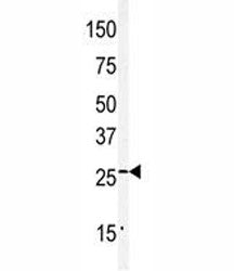 Claudin 2 Antibody (CLDN2)