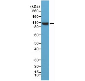 Western blot testing of human HeLa cell lysate with recombinant ACTN4 antibody at 1:1000 dilution. P
